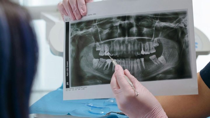 Un dentista sta lavorando sui denti di un paziente in uno studio dentistico.