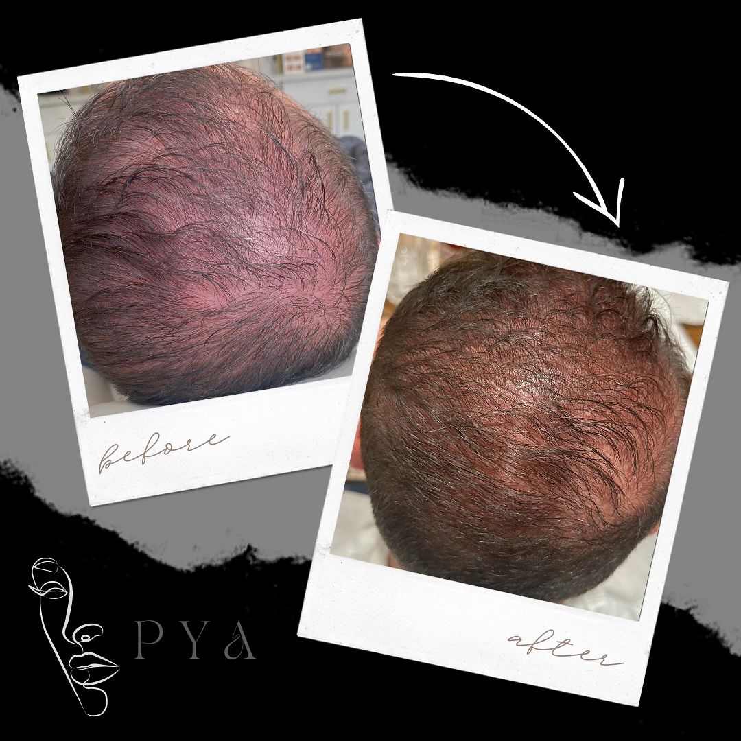 A before and after photo of a person 's hair.