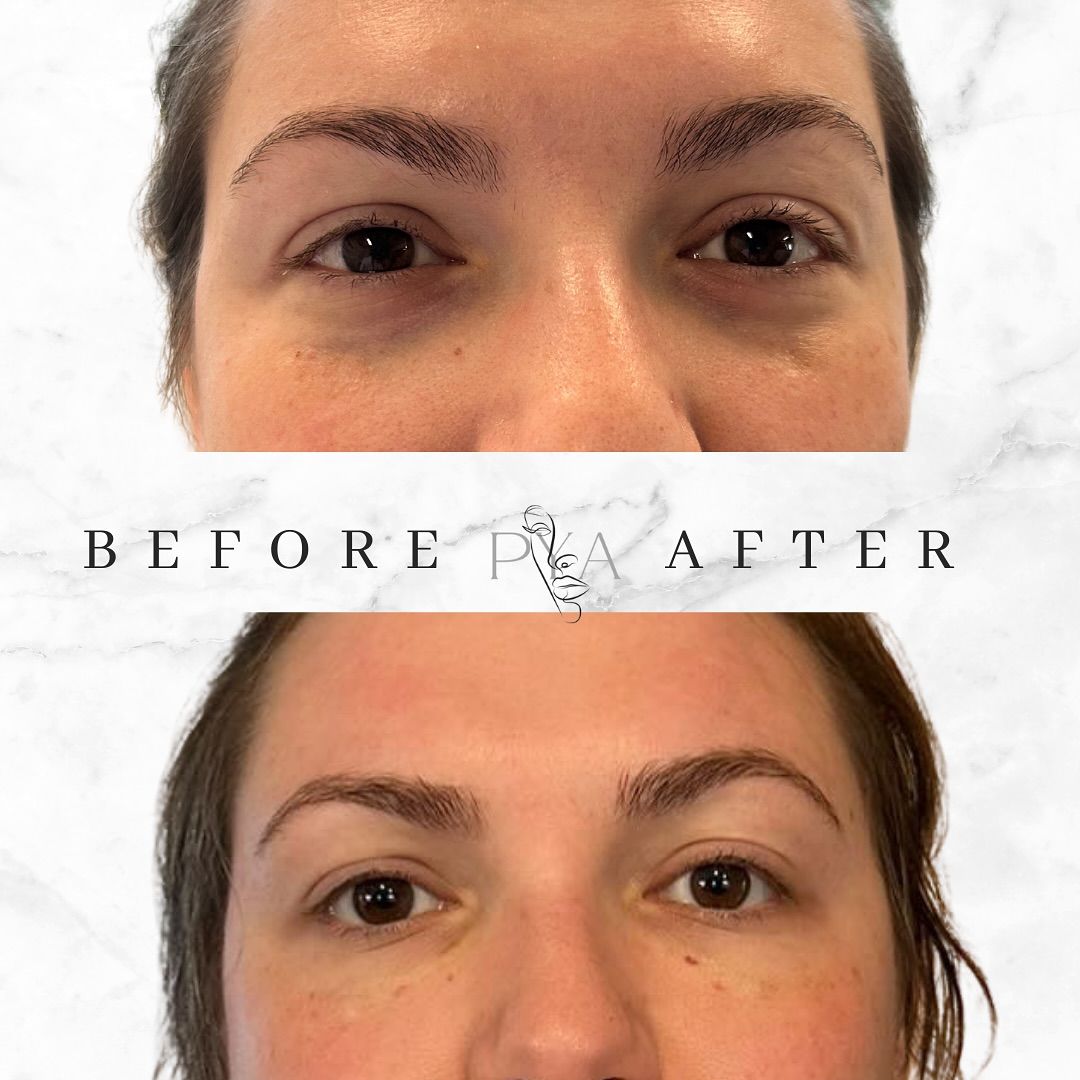 A before and after photo of a woman 's eyebrows.