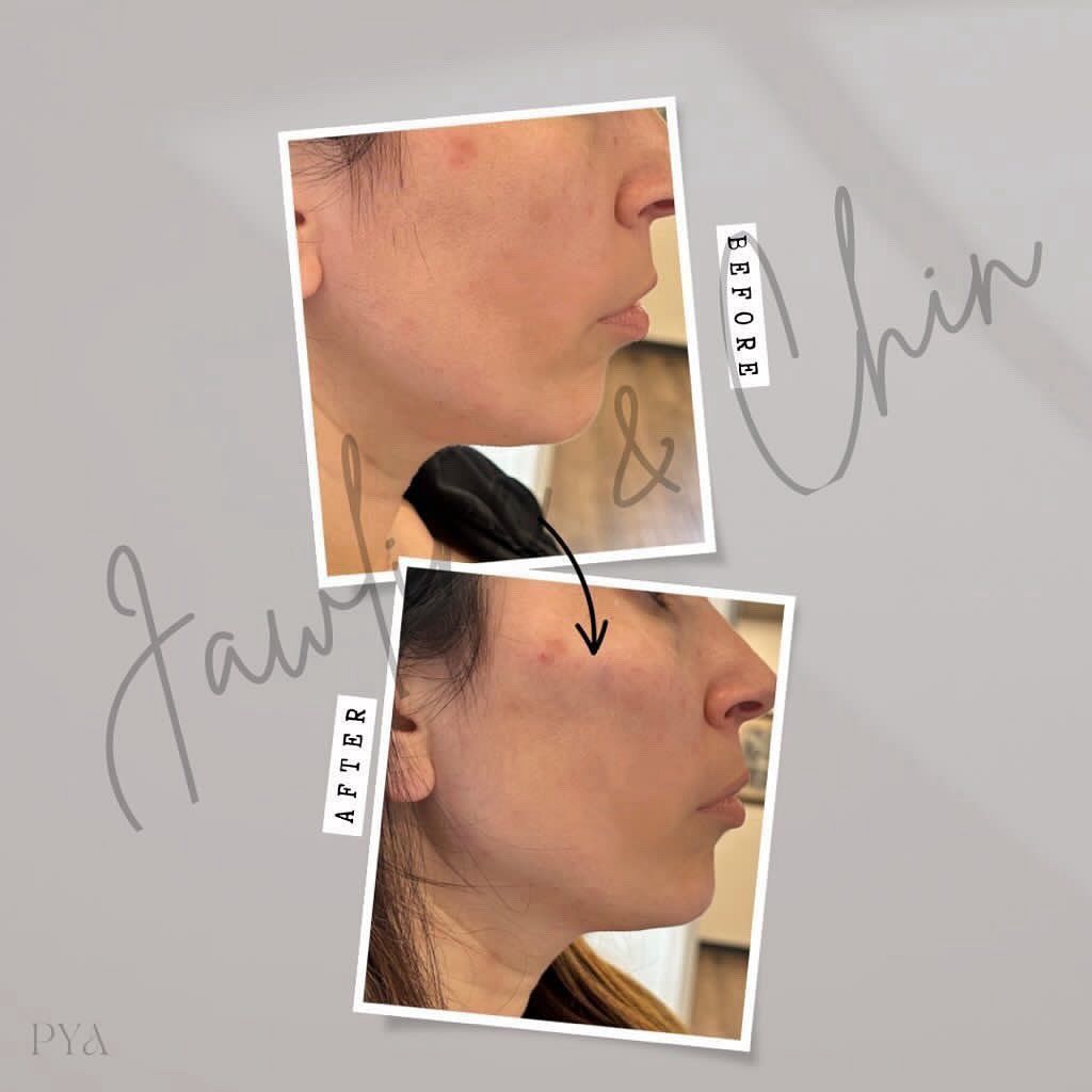 A before and after photo of a woman 's face.