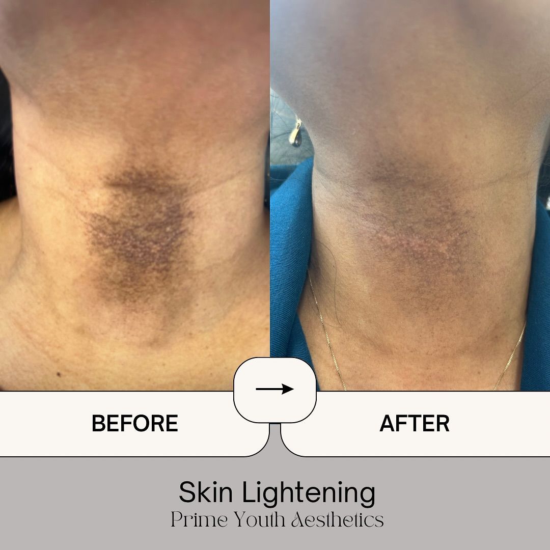 A before and after photo of a person 's neck.