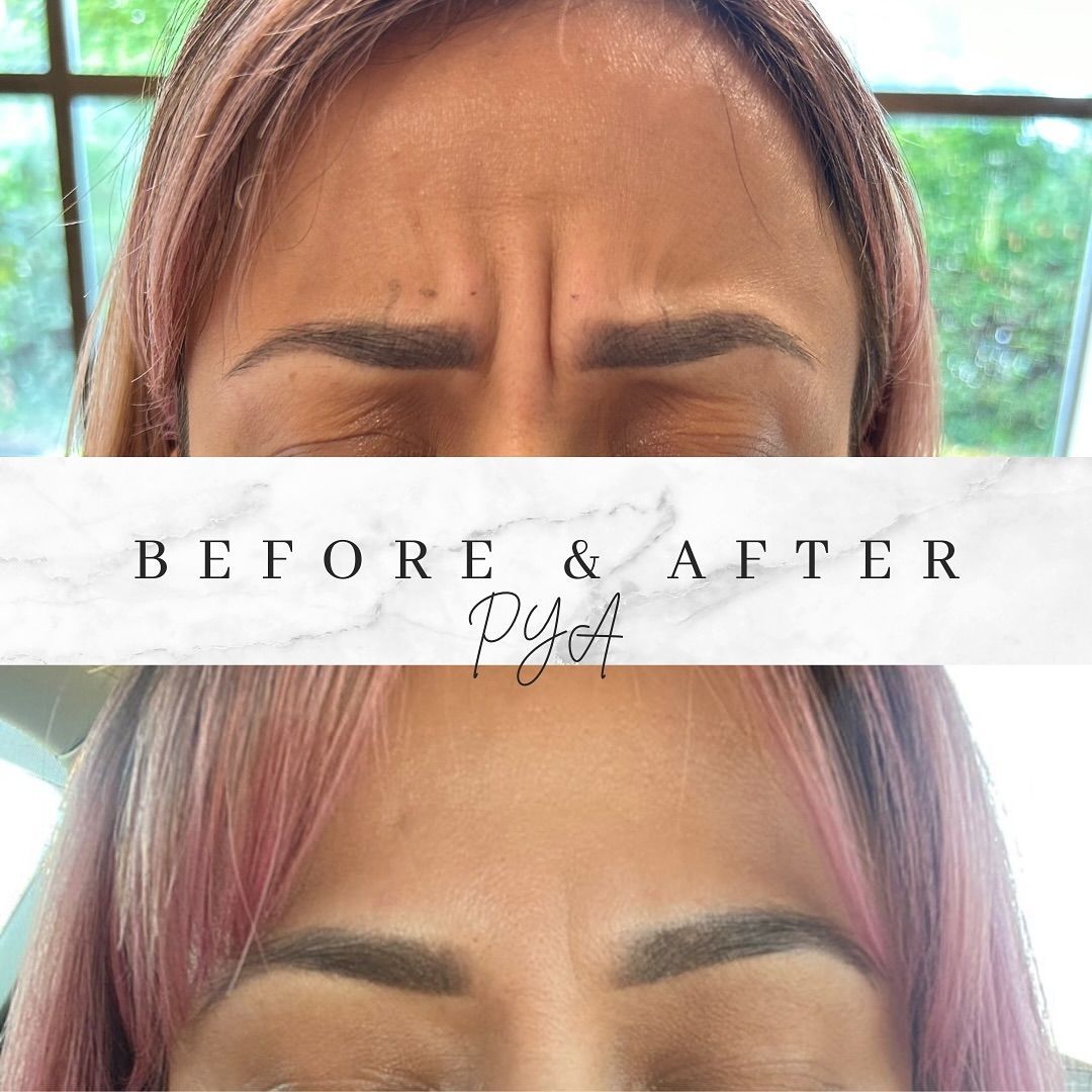 A before and after photo of a woman 's forehead with pink hair.