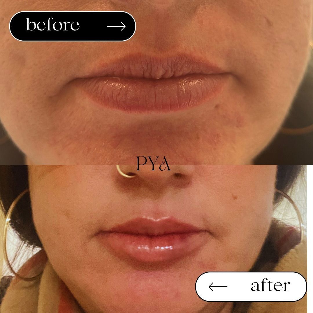 A before and after photo of a woman 's face