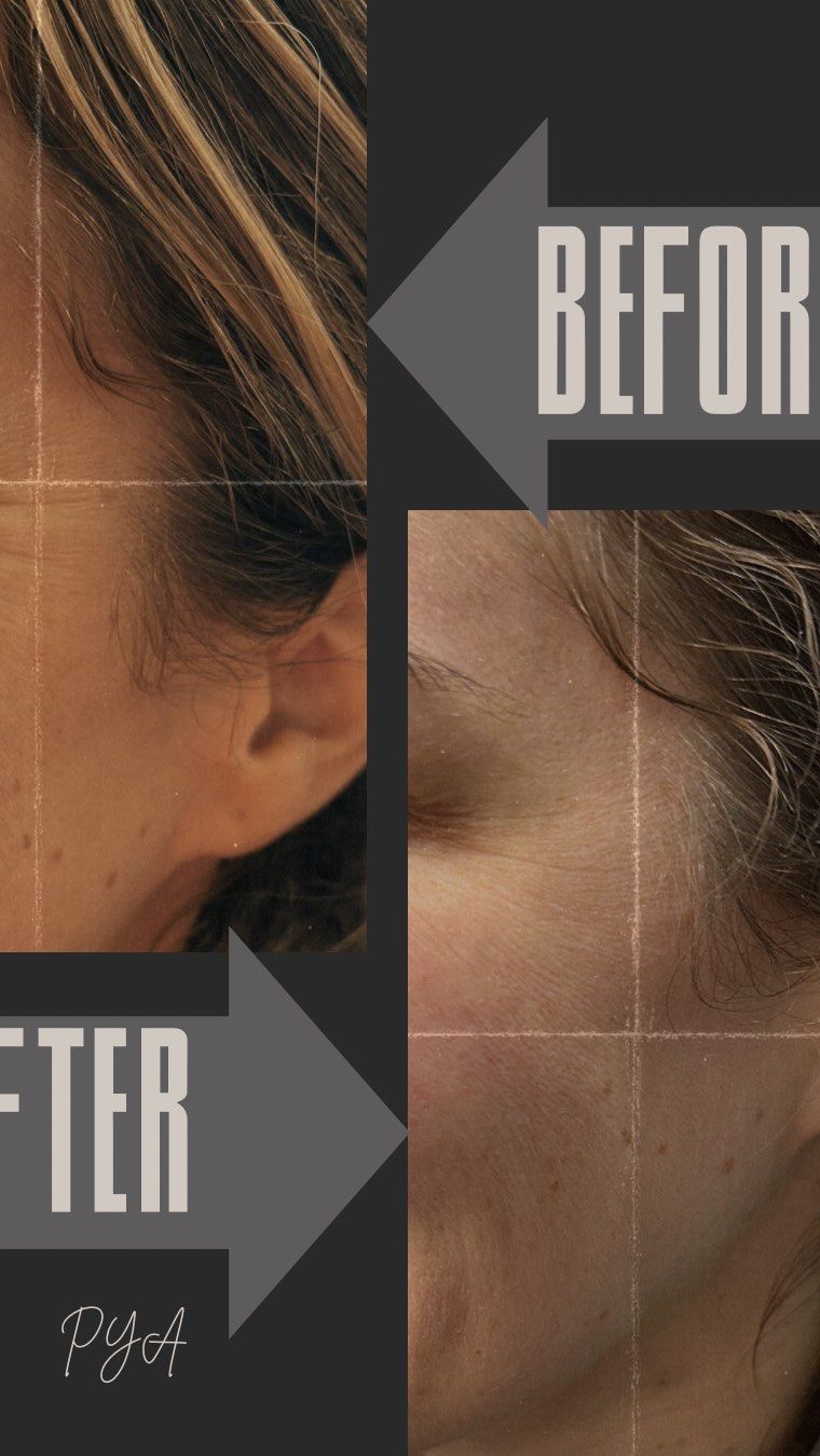 A before and after photo of a woman 's face