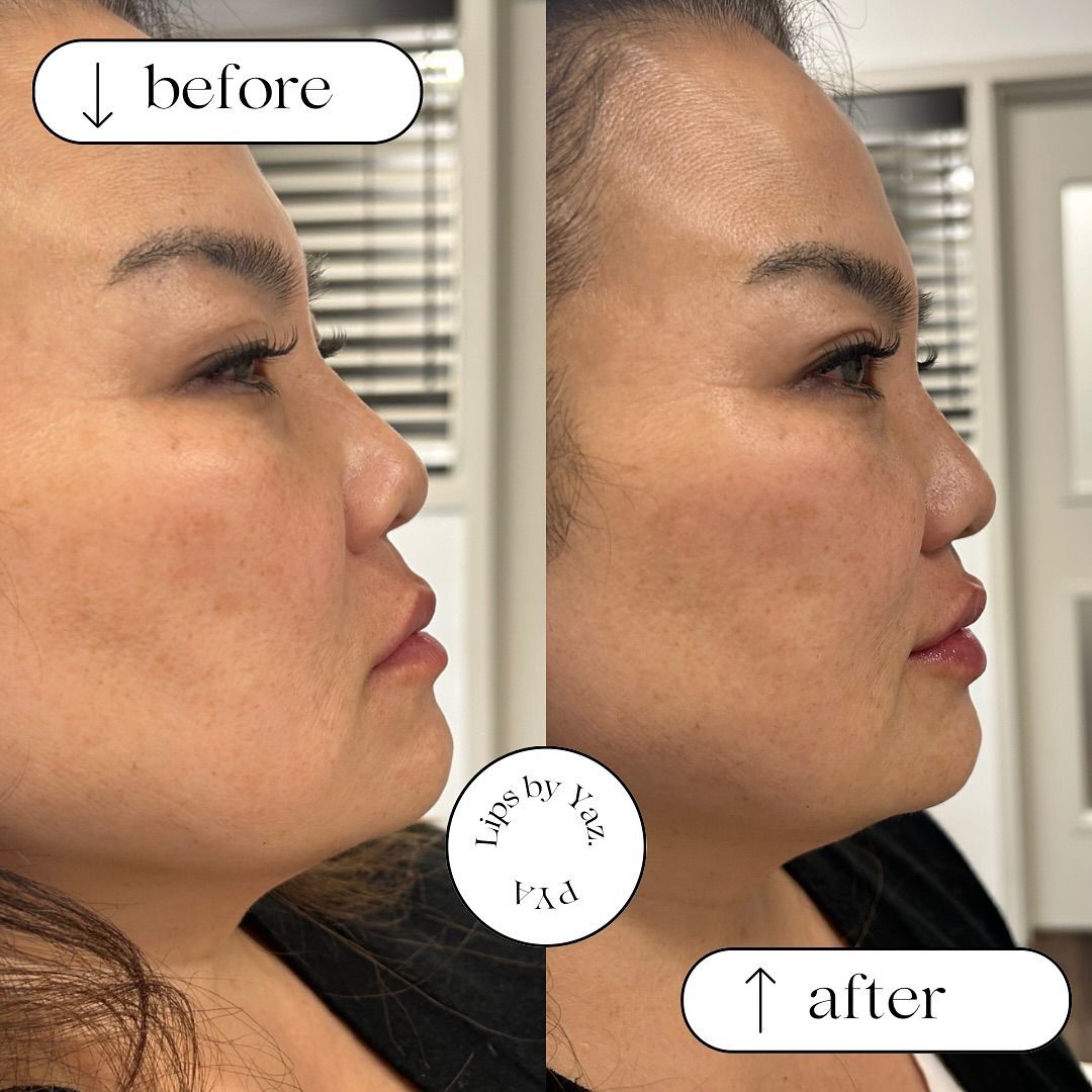 A before and after photo of a woman 's face.