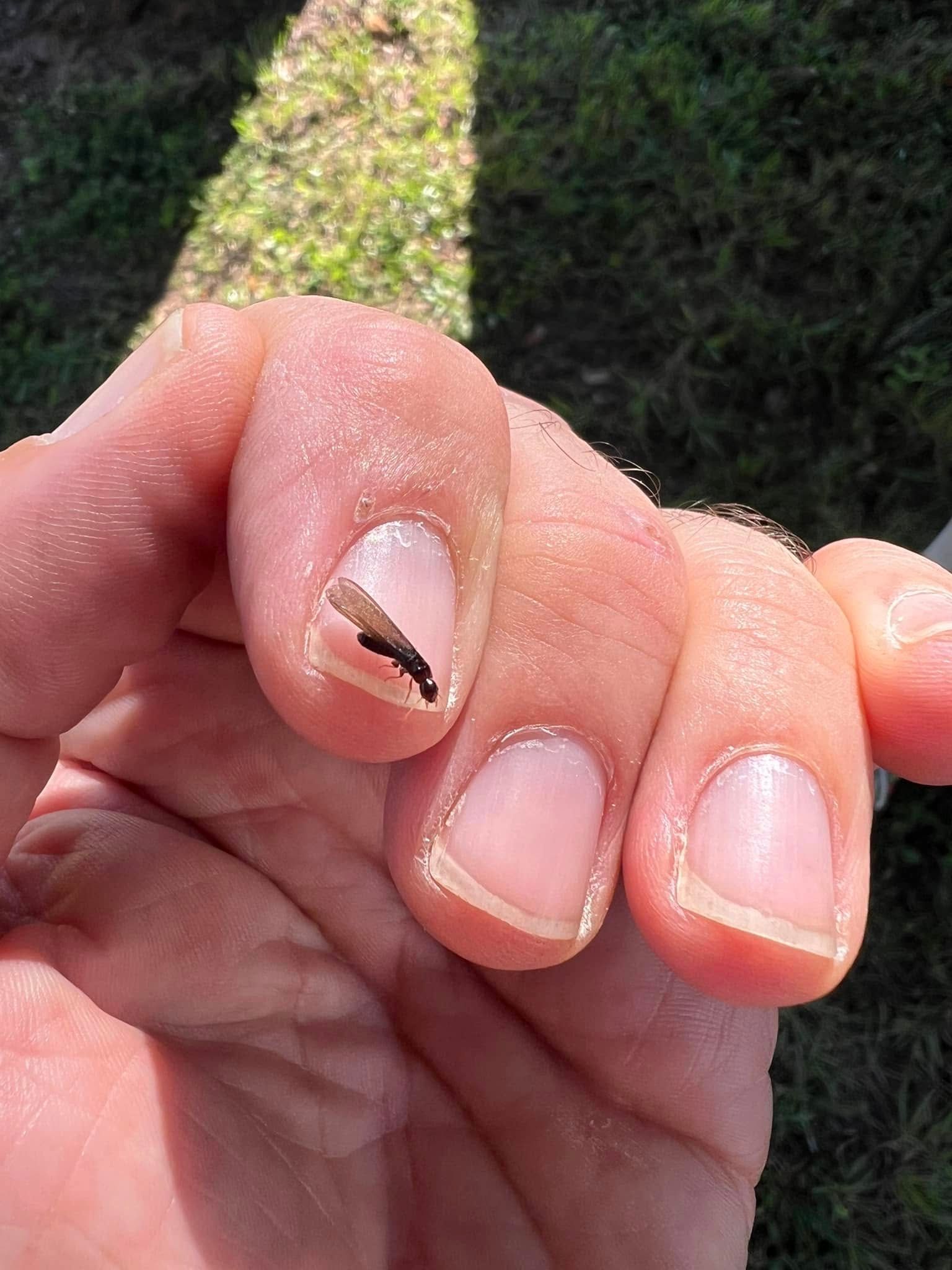 Hand with a damaged fingernail; dark streak and missing section. Sunlight casts shadows on grass.