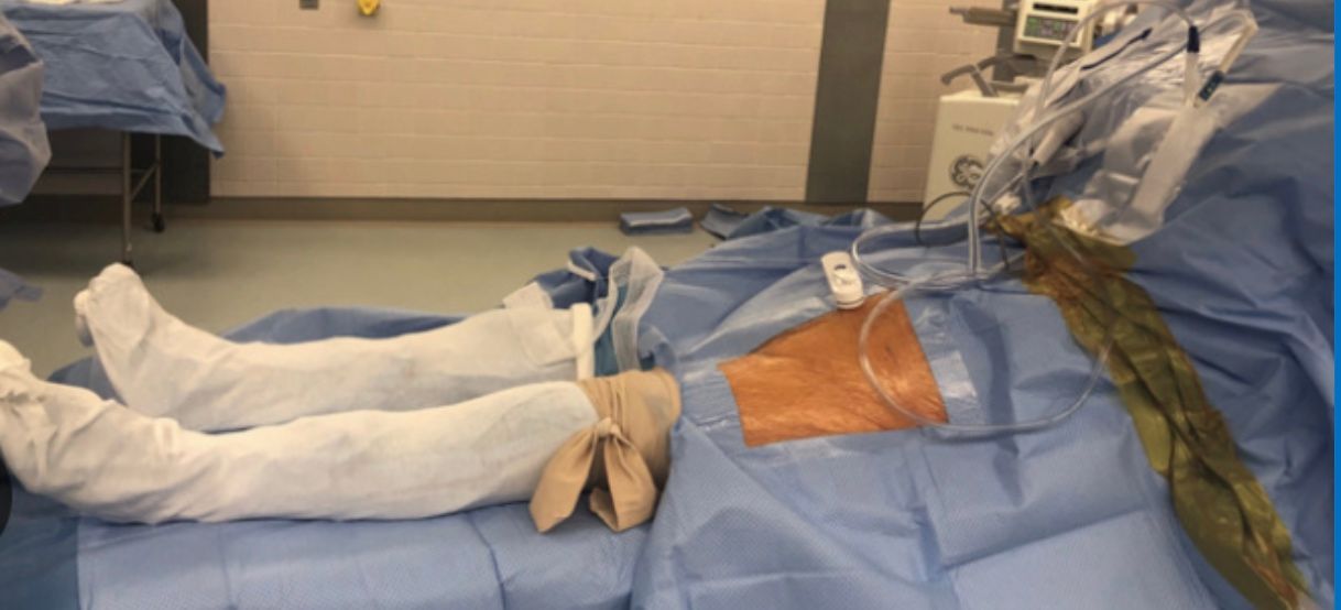 Off-Table Direct Anterior Hip Replacement | David Agolley Orthopaedic Surgeon