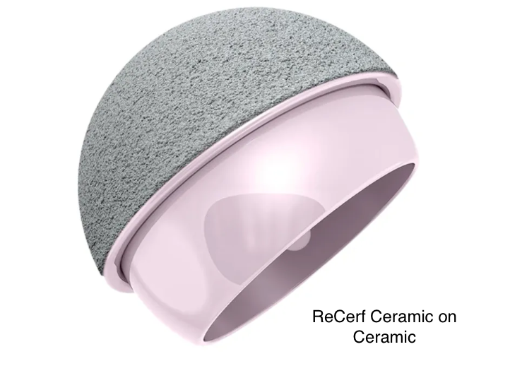 Ceramic on Ceramic (CoC) Hip resurfacing | David Agolley Orthopaedic Surgeon