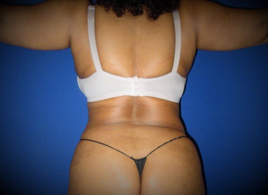 The back of a woman wearing a bra and thong.