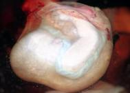 model of fetus - Heavenly Hands Birthing Center