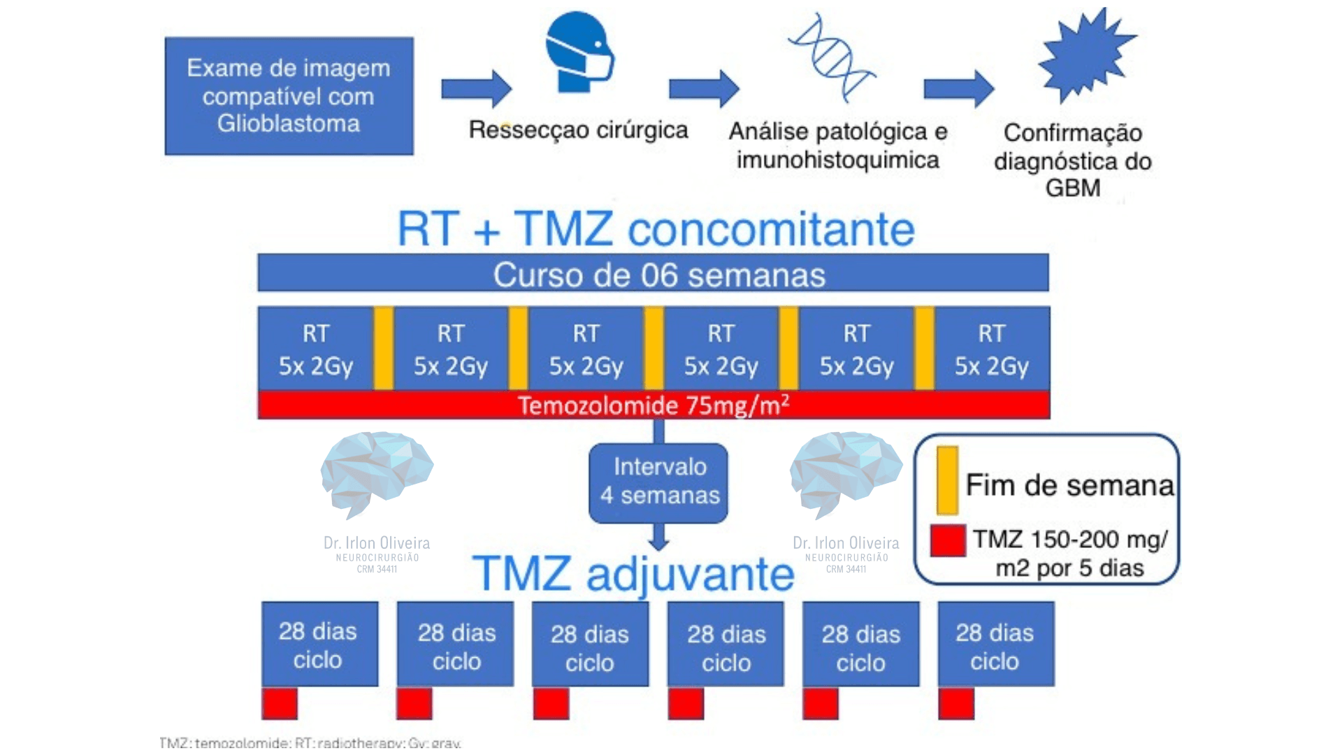 Como é o tratamento do glioblastoma multiforme?