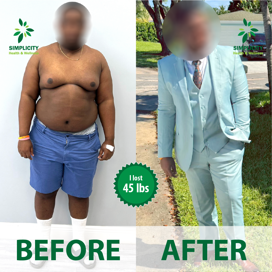 A before and after photo of a man in a suit