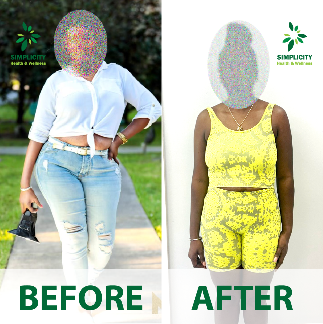 A before and after photo of a woman wearing a yellow top and shorts.