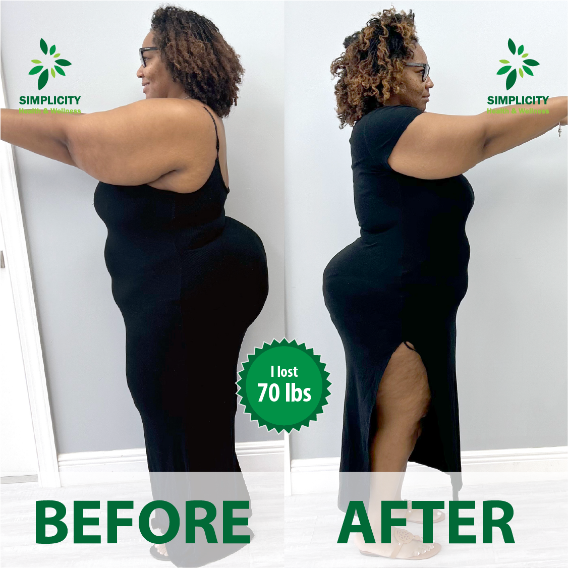 A before and after photo of a woman in a black dress