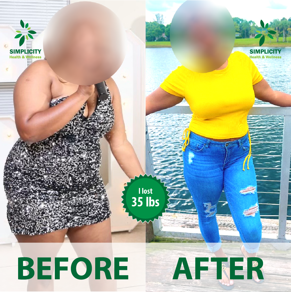 A picture of a woman before and after losing 35 lbs