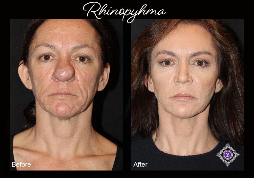 Z Aesthetic Dermatology in Baton Rouge & Prairieville