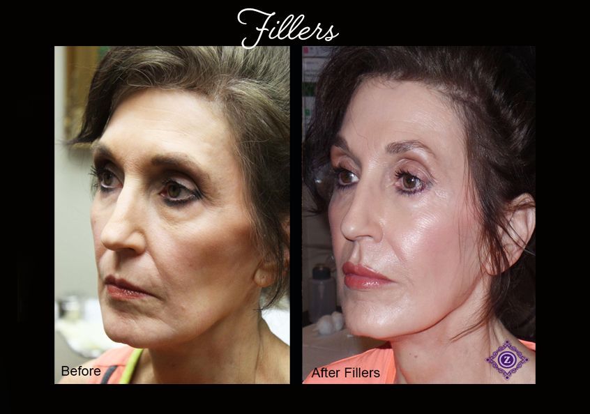 Z Aesthetic Dermatology in Baton Rouge & Prairieville