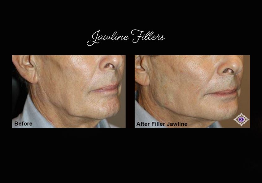 Z Aesthetic Dermatology in Baton Rouge & Prairieville