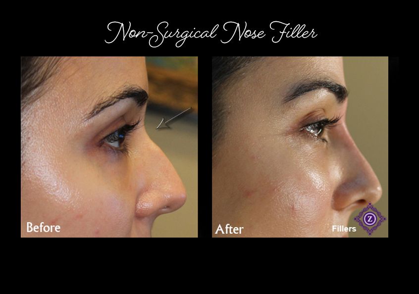 Z Aesthetic Dermatology in Baton Rouge & Prairieville