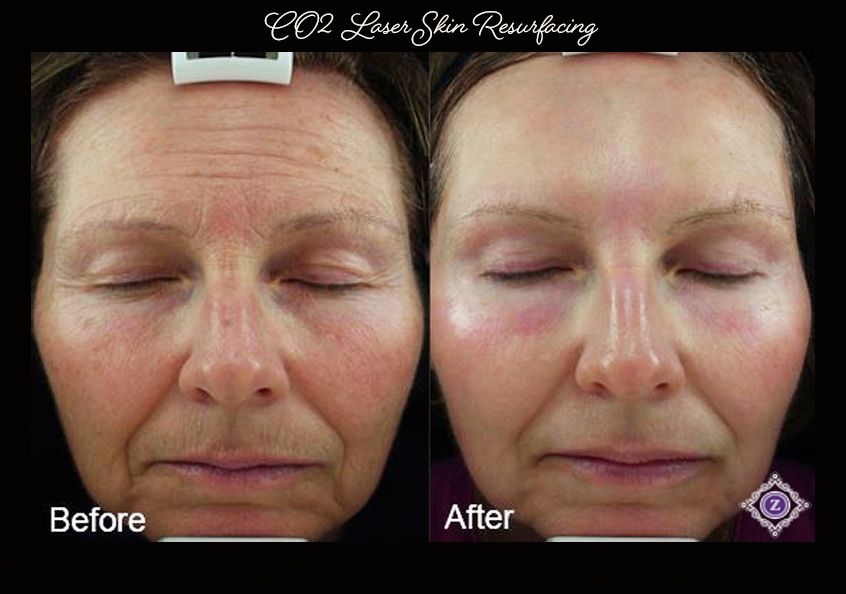 Z Aesthetic Dermatology in Baton Rouge & Prairieville