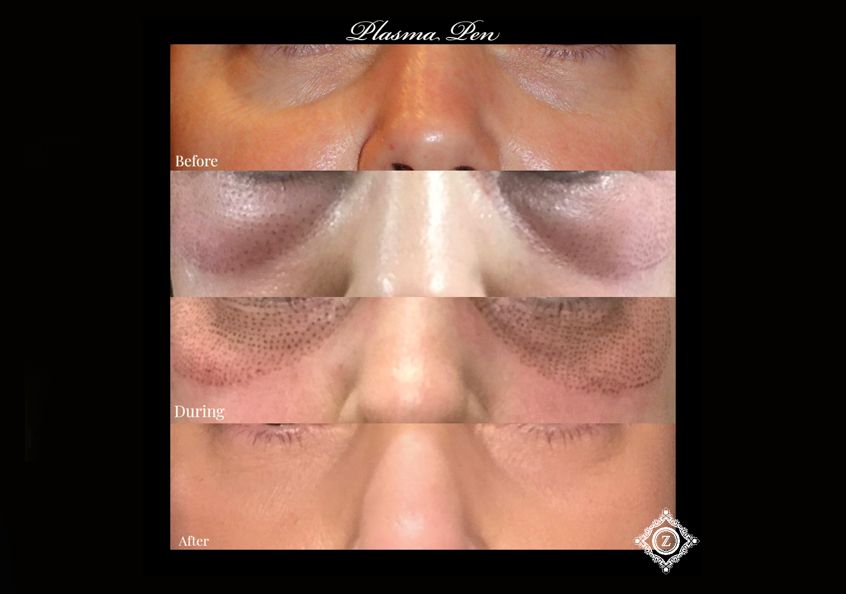 Z Aesthetic Dermatology in Baton Rouge & Prairieville