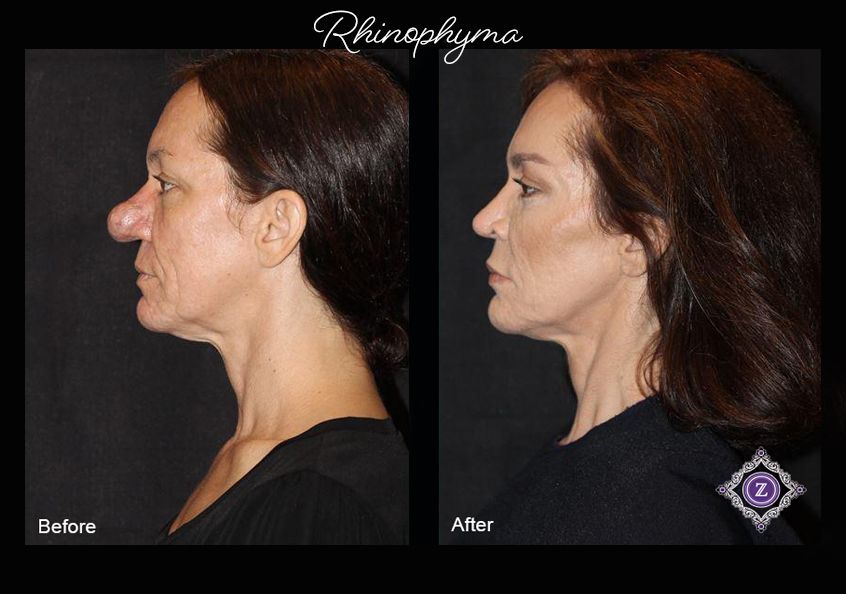 Z Aesthetic Dermatology in Baton Rouge & Prairieville