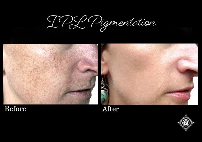 Z Aesthetic Dermatology in Baton Rouge & Prairieville