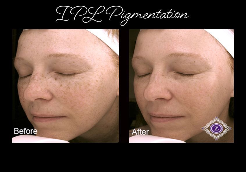 Z Aesthetic Dermatology in Baton Rouge & Prairieville