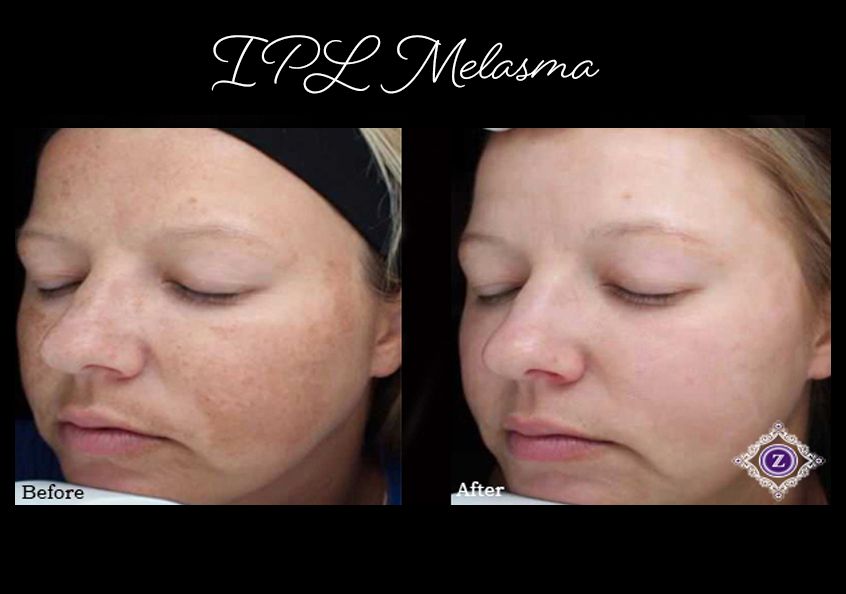 Z Aesthetic Dermatology in Baton Rouge & Prairieville