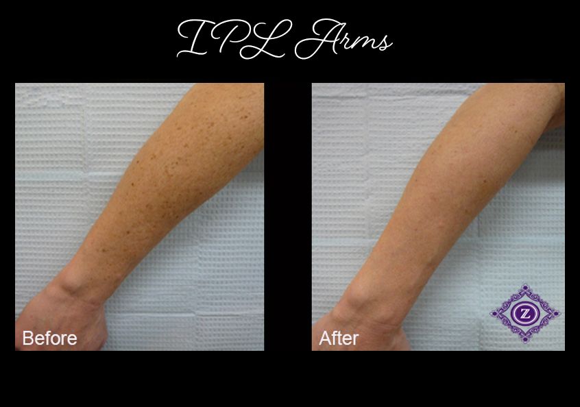 Z Aesthetic Dermatology in Baton Rouge & Prairieville