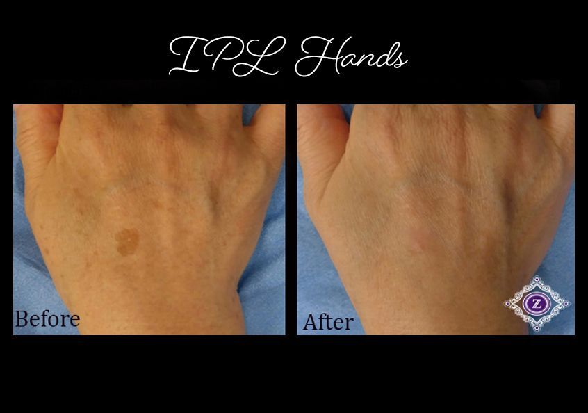 Z Aesthetic Dermatology in Baton Rouge & Prairieville