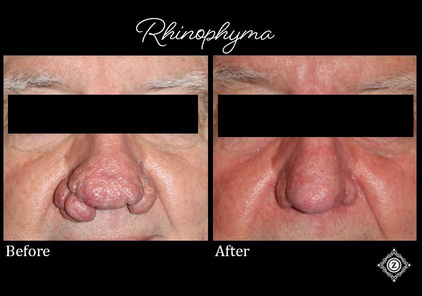 Z Aesthetic Dermatology in Baton Rouge & Prairieville