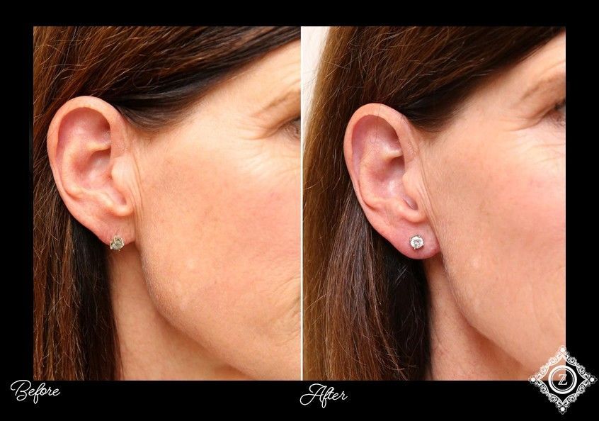 Z Aesthetic Dermatology in Baton Rouge & Prairieville