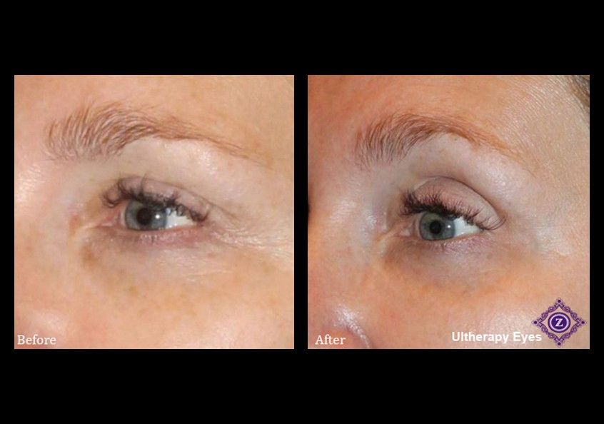 Z Aesthetic Dermatology in Baton Rouge & Prairieville