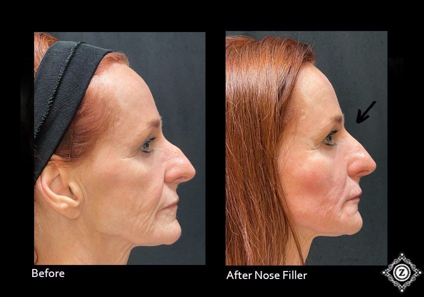 Z Aesthetic Dermatology in Baton Rouge & Prairieville