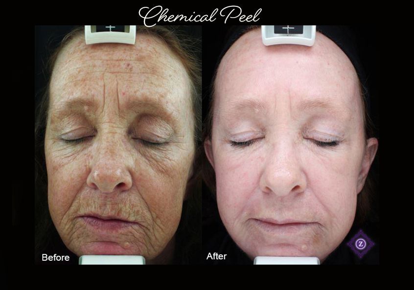 Z Aesthetic Dermatology in Baton Rouge & Prairieville