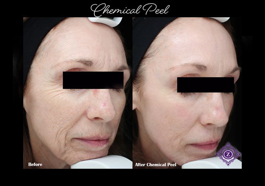 Z Aesthetic Dermatology in Baton Rouge & Prairieville