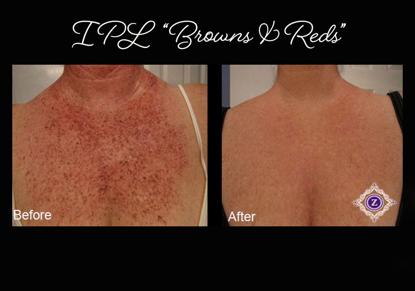 Z Aesthetic Dermatology in Baton Rouge & Prairieville