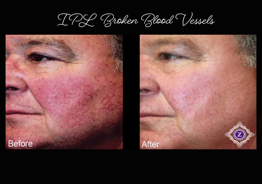 Z Aesthetic Dermatology in Baton Rouge & Prairieville