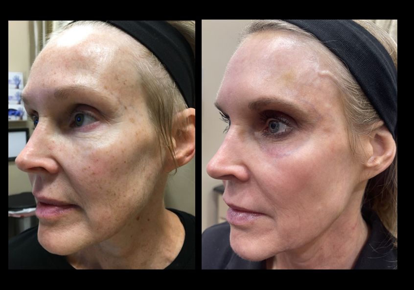 Z Aesthetic Dermatology in Baton Rouge & Prairieville