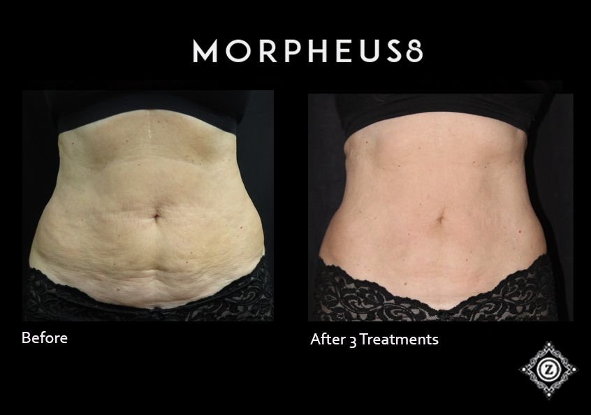 Z Aesthetic Dermatology in Baton Rouge & Prairieville