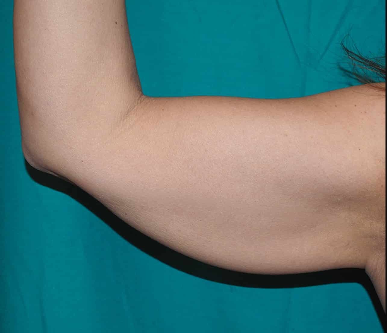 Z Aesthetic Dermatology in Baton Rouge & Prairieville