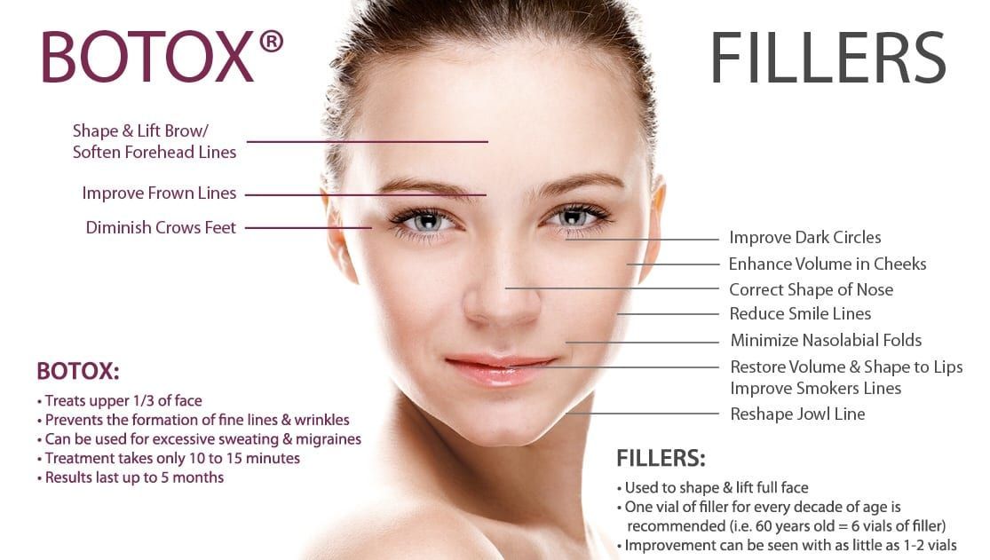 Botox vs dermal fillers comparison guide for injectable treatments in Baton Rouge Louisiana