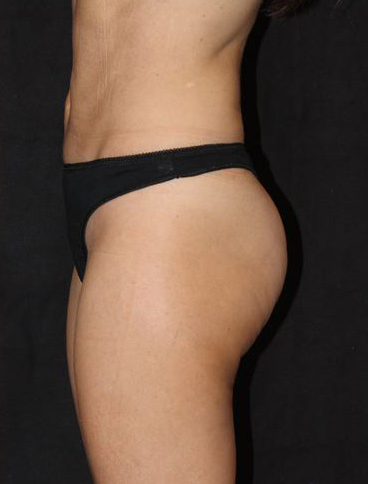 A woman in a black thong is standing in front of a black background.