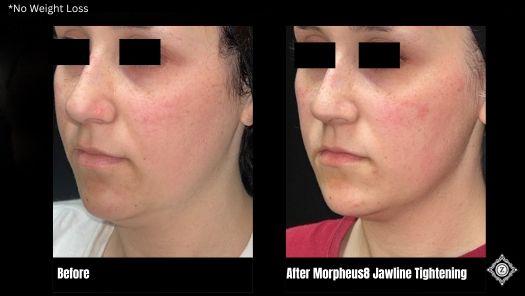 Z Aesthetic Dermatology in Baton Rouge & Prairieville