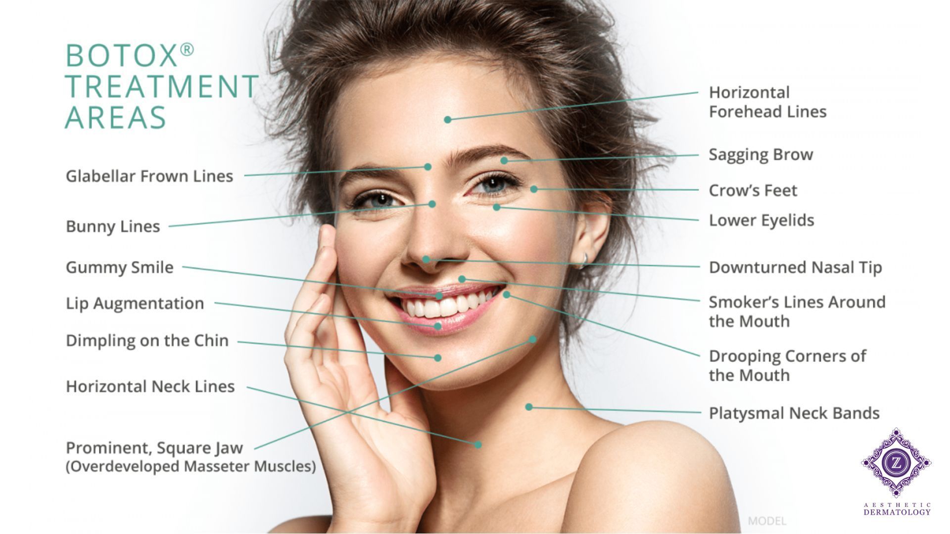 Botox areas to inject for natural results Baton Rouge Prairieville