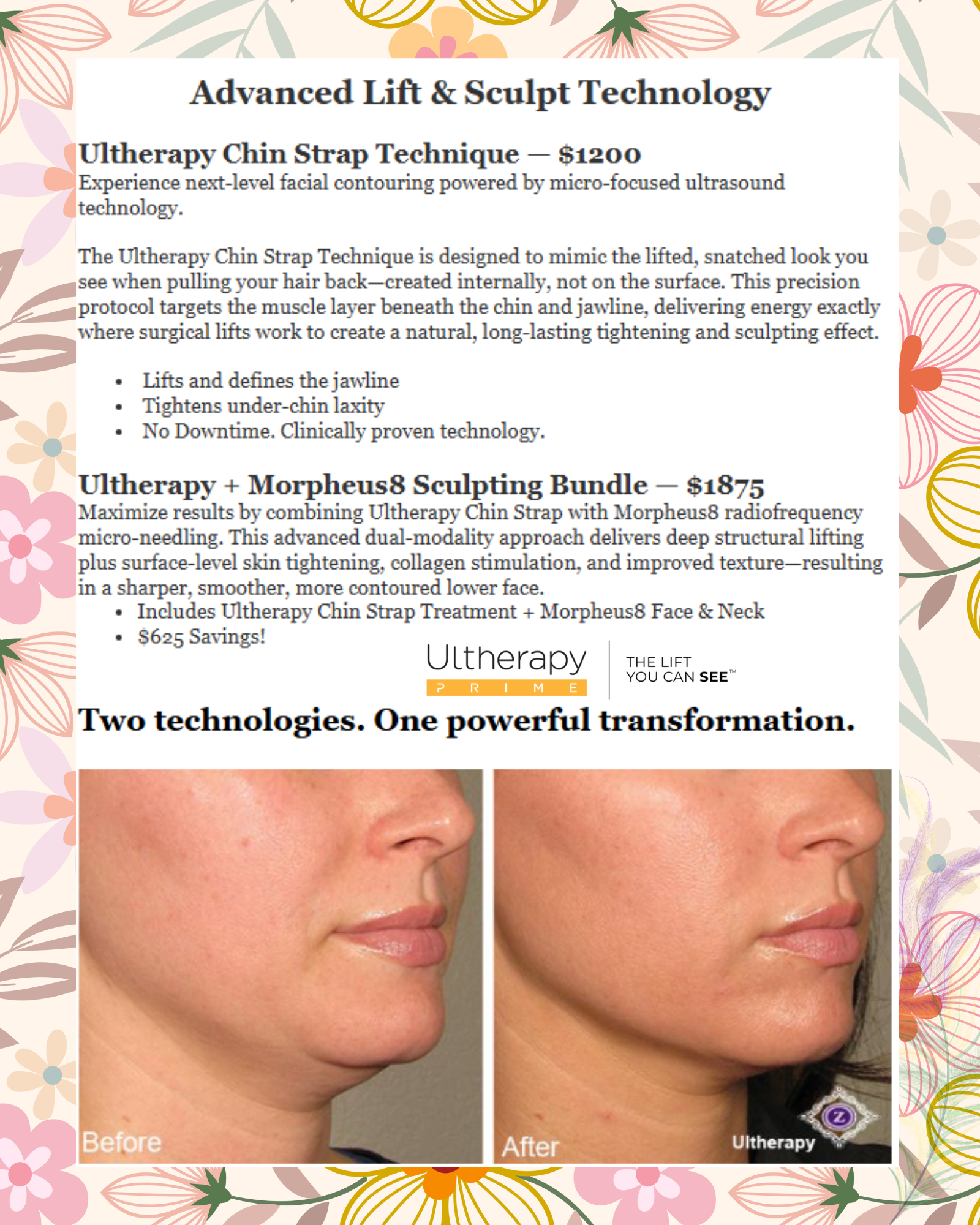 Skincare advertisement: Z Brand products with 20% off. Four bottles on brown background with water droplets.