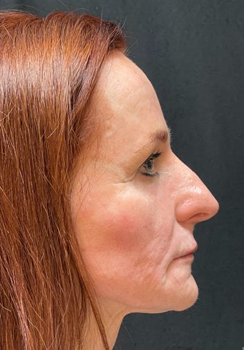 A close up of a woman 's face with red hair against a black background.