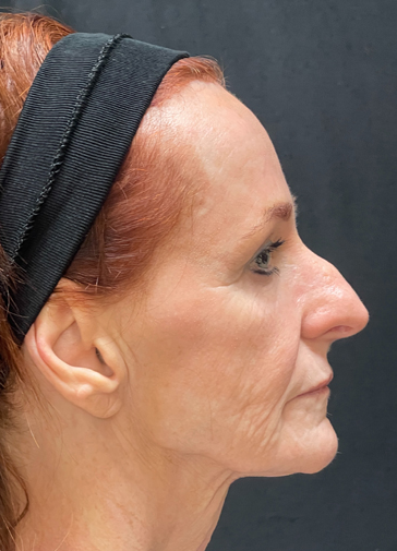 A close up of a woman 's face with a headband on.