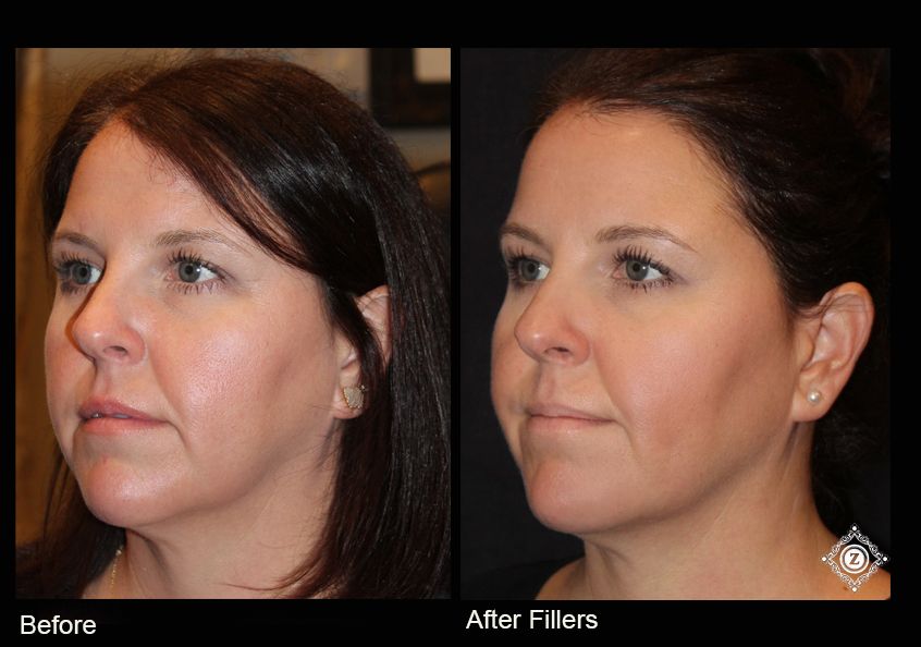 Z Aesthetic Dermatology in Baton Rouge & Prairieville